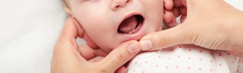 Baby Bottle Tooth Decay: Caused by prolonged exposure to sugary liquids, harming baby teeth. Prevent with proper oral hygiene & limiting sugary drinks.