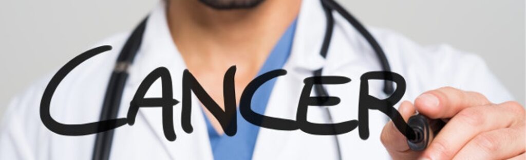 Oral Cancer: What you need to know